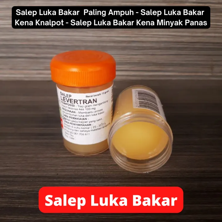 8 Salep Luka Bakar dan Obat Luka Bakar Alami Supaya Cepat Sembuh